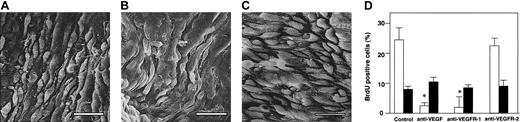 Figure 7. Effects of VEGF antibodies in α2-AP-/- mice. Scanning electron photomicrographs of the regenerated endothelial surface of a carotid artery 48 hours after injury in α2-AP-/- mice. When either VEGF antibody or anti-EGFR-1 antibody was administered to α2-AP-/- mice, the regeneration of the endothelium was normalized (A-B, respectively). α2-AP-/- mice treated with an anti-VEGFR-2 antibody showed a prompt and dense re-endothelialization (C). Cell proliferation (n = 4) measured as the BrdU index (percentage) of recovered endothelial cell layer (□) and SMCs in media (•) following vascular injury in α2-AP-/- mice (D). An anti-VEGF antibody and antibodies against VEGFR-1 (Flt-1) or VEGFR-2 (KDR), (25 μg per body) were injected as a bolus 5 minutes before the initiation of endothelial injury in α2-AP-/- mice (n = 3, each group). BrdU (50 mg/kg) was injected subcutaneously 1, 8, 16, and 24 hours prior to removal of the carotid arteries. Two days after the injury, the injured artery was removed and stained for the measurement of BrdU-positive cells. * indicates P < .05 control. Scale bars represent 10 μm.