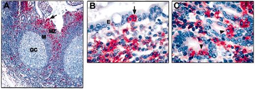 Figure 5. IRTA1 expression in Peyer patches. (A) Expression of IRTA1 is topographically restricted to the marginal zone (MZ) including isolated or small clusters of intraepithelial B cells (arrows) in the dome epithelium; cells in the germinal center (GC) and mantle (M) of B-cell follicles are IRTA1-. (B-C) Other areas of Peyer patches showing, at higher magnification, that IRTA1 is selectively expressed by marginal zone (MZ) B cells including intraepithelial B cells. The arrow in panel B and the arrowheads in panel C point to IRTA1+ intraepithelial B cells. APAAP technique with mAb M-IRTA1; hematoxylin counterstain. Original magnifications × 100 (A); × 1000 (B-C).