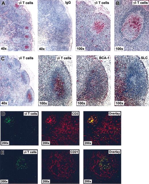 Figure 5. γδ T cells cluster in B-cell follicles within secondary lymphoid tissues. Immunohistochemical analysis of tissue section from human biopsy specimen by means of bright field (A-C) and fluorescence microscopy (D-E). (A) Normal abdominal LN, (B) gut follicle from a patient with ileitis (Yersinia), and (C) draining LN from a patient with appendicitis (Yersinia). Red staining in panels A-C depicts positivity for γδ T cells using a goat Ab against pan-VγVδ-TCR or BCA-1 and SLC as indicated using mouse mAb, and IgG refers to negative control staining with isotype-matched unrelated Ab. (D-E) Assessment of γδ T-cell distribution in sections of an abdominal LN from a patient with yersiniosis. Double-fluorescence images show localization of γδ T cells in green, CD3+ T cells (D) and CD21+ FDCs (E) in red, and the corresponding superimposed images (overlays).
