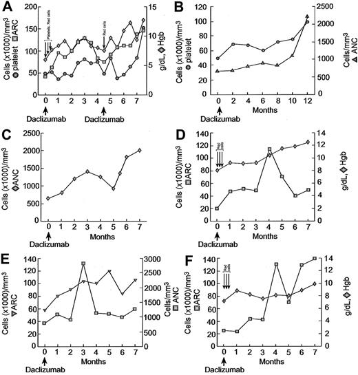 Figure 1. Response of patients with mAA to daclizumab. Serial blood counts of patients treated with daclizumab. Each panel represents data from 1 patient. Platelets and red cells were given to Patient 1 (panel A) for bleeding.