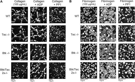 Figure 6. Btk-/-/Tec-/- platelets display reduced spreading responses on a collagen monolayer but exhibit normal responses on fibrinogen. Murine platelets from the 4 genotypes in PRP were allowed to sediment for 30 minutes onto either (A) collagen or (B) fibrinogen-coated coverslips. The sedimentation was allowed to occur as control, in the presence of ADP (3 μM) or with inhibition of Src kinases by PP1 (20 μM). After 30 minutes the sedimented samples were fixed using 3.2% formaldehyde, subsequently washed with PBS, and stained for F-actin using rhodamine-phalloidin. (A) Wild-type (WT), Btk-/-, and Tec-/- but not Btk-/-/Tec-/- platelets spread along collagen fibers. With the addition of ADP all genotypes showed spreading, and in the presence of PP1 all genotypes displayed inhibition. Platelets sedimenting on collagen were in the presence of 10 μM lotrafiban to remove the effects of GPIIbIIIa. (B) All genotypes show spreading on fibrinogen with or without ADP. Pictures displayed are small fields of view from separate experiments obtained using a × 100 objective and are representative of 3 experiments.
