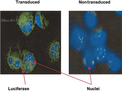 Figure 1. Detection of luciferase expression in CD34+ cells by immunohistochemistry. Cytospin slides prepared from transduced CD34+ cells after 3 days of culture were stained with monoclonal antiluciferase antibody. Luciferase-positive cells have green cytoplasm; nuclei stained with DAPI are blue. Nontransduced, cultured CD34+ cells were used as a negative control. Original magnification, × 40.