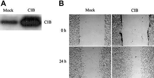 Figure 2. CIB overexpression induces cell migration. (A) Western blot analysis of the extent of CIB overexpression compared with endogenous levels. (B) Serum-starved mock- and CIB-transfected CHO cells were grown to confluency on fibronectin to form a monolayer, which was then wounded and observed at 0 and 24 hours. Original magnification, × 100.