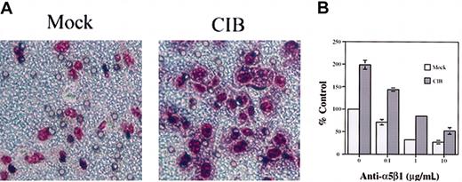Figure 3. CIB induces cell migration through integrin α5β1 (A) Mock- and CIB-overexpressed cells were allowed to migrate for 5 hours across transwell inserts coated on the underside with fibronectin. Unmigrated cells were removed, and migrated cells were fixed and stained. Original magnification, × 200. (B) Mock- and CIB-overexpressed cells were incubated with increasing concentrations of function-blocking anti-α5β1 for 20 minutes and were then allowed to migrate across fibronectin-coated inserts in the presence of function-blocking antibody for 5 hours. Error bars indicate mean ± SEM of at least 3 independent experiments.