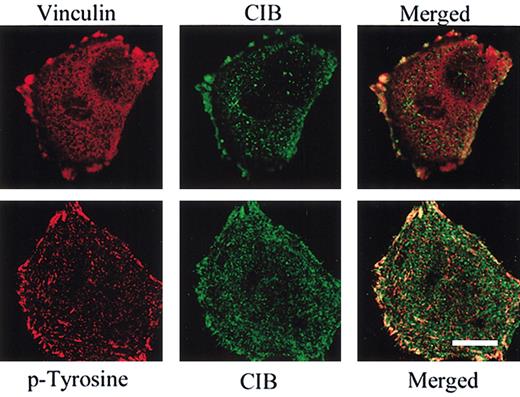 Figure 4. CIB localizes at the focal adhesions. Immunofluorescent images of CHO cells plated on fibronectin for 60 minutes and immunostained for endogenous CIB, vinculin, or phosphotyrosine (p-Tyrosine). The merged image shows that CIB colocalizes at areas of focal adhesions. Scale bar, 10 μm.