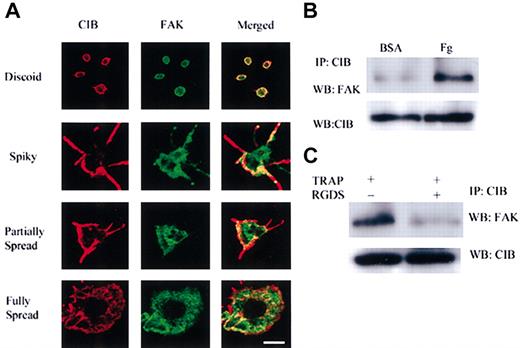 Figure 7. CIB associates with FAK in human platelets. (A) Immunofluorescence analysis of CIB and FAK localization in platelets throughout the stages of platelet adhesion to immobilized Fg. Scale bar, 1 μm. (B) Immunoprecipitation of CIB from platelet lysates of cells adhered to Fg or BSA. Western blot analysis with anti-FAK shows the association between CIB and FAK increases on platelet adhesion to Fg. (C) Immunoprecipitation of CIB from TRAP-activated platelet lysates in the presence or absence of RGDS. Western blot analysis with anti-FAK shows the association between CIB and FAK is blocked on inhibition of the ligand binding.