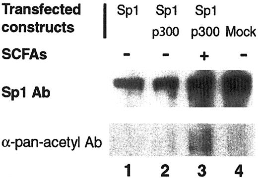 Figure 6. Western blot with SP1 and αpan-acetyl antibody against cellular extracts from nonerythroid cells that had been transfected with SP1, with or without p300 and with or without SCFAs, and immunoprecipitated with SP1. NIH/3T3 cells were transfected with SP1 and/or p300 and exposed to SCFAs for 48 hours, as indicated. Whole-cell extracts were immunoprecipitated with antibodies raised against SP1, run on a 12% acrylamide gel, transferred to nitrocellulose, and probed with antibody raised against a mix of acetylated proteins (lower blot). The membrane was then stripped and rehybridized with the antibody raised against SP1 (upper blot). The visualized bands ran between the 75- and 105-kDa standards.