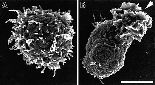 Figure 1. SDF-1α induces loss of microvilli concurrent with polarization. Scanning electron micrographs from field emission SEM of human PBT cells before (A) and after (B) 1 minute of stimulation in suspension with 100 ng/mL SDF-1α. Cells were stimulated, fixed, and processed for SEM as described in “Materials and methods.” The arrow indicates the ruffled leading edge of the polarized lymphocyte. Bar represents 2.5 μm.