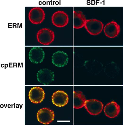 Figure 6. Dephosphorylation and redistribution of PBT cell ERM in response to SDF-1α Confocal micrographs showing the distribution of cpERM (green, mAb 297s) versus total ERM (red, polyclonal antiezrin) in human PBT cells detected by indirect immunofluorescence before and 1 minute after stimulation with 100 ng/mL SDF-1α. Resting cells exhibit a peripheral, punctate distribution of cpERM, colocalized with punctate staining of total ERM protein. Following SDF-1α stimulation, the cpERM signal is lost, as are punctate spots of total ERM staining, indicating ERM T558 dephosphorylation and redistribution. Images are single optical sections 1 μm in thickness acquired at the approximate mid-plane of cells (bar represents 5 μm).