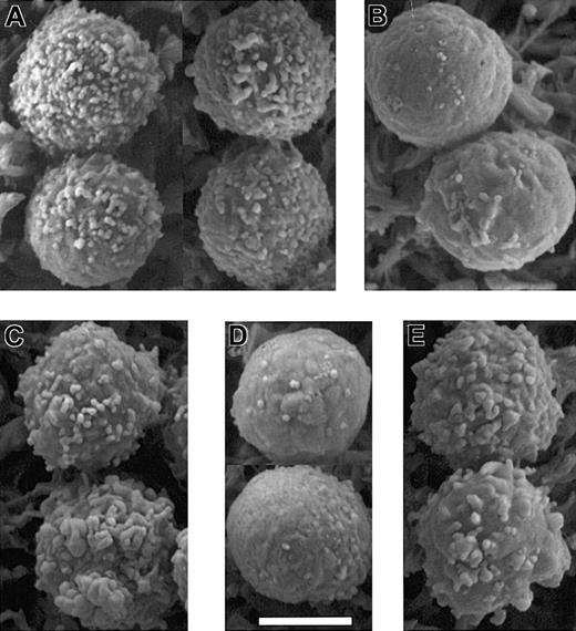 Figure 7. Kinase and phosphatase inhibitors alter microvilli in a manner predicted by their effects on ERM phosphorylation. Scanning electron micrographs of PBT cells that were: (A) untreated; (B) treated with 500 nM staurosporine A for 30 seconds; (C) treated with 50 nM calyculin A for 5 minutes; (D) treated with SDF-1α for 30 seconds; and (E) pretreated with 50 nM calyculin A for 5 minutes before treatment with SDF-1α for 30 seconds. Bar represents 5 μm. Microvilli appear shorter in these images acquired by conventional SEM using samples dehydrated by chemical drying with tetramethylsilane rather than field emission SEM of samples dehydrated by critical point drying (Figure 1).