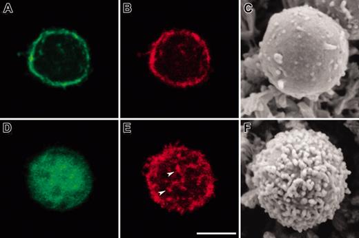 Figure 8. Transfection of dominant-negative ezrin construct into PBT cells ablates surface structures. PBT cells were “nucleofected” with either plasmid encoding ezrin FERM-GFP (A-C) or encoding GFP alone (D-F). After 24 hours of culture, portions of each preparation of cells were prepared for confocal fluorescence microscopy by fixation, permeabilization, and staining with Alexa Fluor 568 phalloidin. The remaining portions were prepared for conventional SEM using chemical drying with tetramethylsilane. FERM-transfected cells showed localization of the FERM-GFP protein (A) in submembranous regions, whereas GFP-transfected cells showed diffuse cytoplasmic and nuclear staining (D). GFP-transfected cells had a fine punctate distribution of actin (arrowheads), which is characteristic of normal PBT (E). In contrast, FERM-GFP–transfected cells generally lacked this fine punctate distribution of actin (B). SEM of PBT cells transfected with FERM-GFP revealed a distinctive “bald” phenotype (C). This “bald” phenotype was not observed in GFP-transfected cells (F). Bar indicates 5 μm.