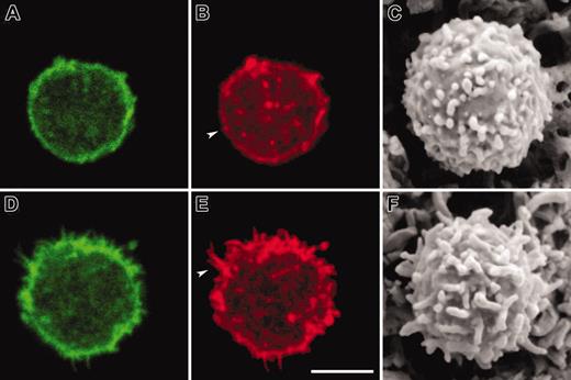 Figure 9. Increased prominence of peripheral processes in PBT cells transfected with a moesin construct that mimics the phosphorylated form. PBT cells were “nucleofected” with a moesin construct that mimics the unphosphorylated form (moesin-T558A-HA; A-C), or a construct that mimics the phosphorylated form (moesin-T558D-HA; D-F). After 24 hours of culture, the cells were fixed, permeabilized, and stained with Alexa Fluor 568 phalloidin, and anti-HA–FITC. Panels show the confocal images on distribution of actin (B,E; red) and that of the HA-tagged moesin (A,D; green) and corresponding conventional SEM images prepared using chemical drying with tetramethylsilane (C,F). Arrowheads in panels B and E refer to peripheral processes on the cell body representing microvilli. Bar represents 5 μm.