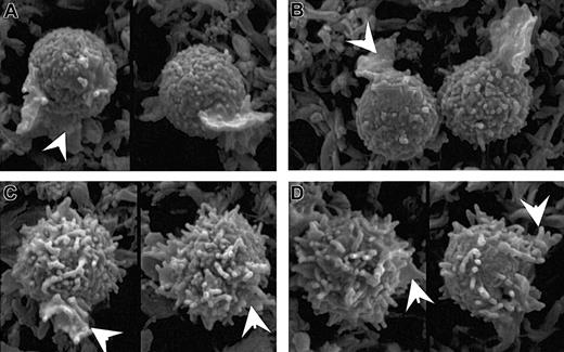 Figure 10. Delayed loss of microvilli in moesin-T558D–transfected cells in early stages of polarization. PBT cells were “nucleofected” with a moesin construct that mimics the unphosphorylated form (moesin-T558A-HA; A-B), or a construct that mimics the phosphorylated form (moesin-T558D-HA; C-D). Samples were prepared for conventional SEM using chemical drying with tetramethylsilane. After 30 seconds (A,C) and 60 seconds (B,D) cells were observed in early stages of polarization, identifiable by the presence of ruffles (arrowheads), but absence of a well-formed lamellipodium. Such cells in T558D-transfected cells generally retained coarse microvilli but in T558A-transfected cells had generally lost microvilli. All images were acquired at × 6000 and relative size was maintained during figure composition.