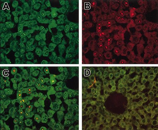 Figure 6. Cotransduction of hepatocytes in vivo. Hem-A mice were injected with 3 × 1011 vg/mouse of both AAV-cFVIII-HC and AAV-cFVIII-LC. Treated and naive livers were harvested 15 weeks after injection and analyzed by FISH for RNA expression (A-D). Sections were probed sequentially with a heavy-chain–specific probe (green; A) and then with a cocktail of 2 light chain–specific probes (red; B). Colocalization of both transcripts is indicated by the yellow staining (yellow; C). No signal was seen in sections from untreated mice (D). Original magnification, ×40.