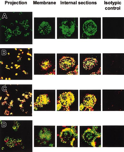 Figure 3. Confocal microscopy of IL-12/IL-12Rβ1 colocalization in B cells. Untreated and 24-hour IFN-γ-activated primary B cells were treated with recombinant IL-12 for 15 minutes at 4 or 37°C, before intracellular staining with anti-IL-12 and anti-IL-12Rβ1. Confocal microscopic analysis of serial 1-μm optical sections was performed from the cell surface to the cell interior. Superimposed IL-12 (red) and IL-12Rβ1 (green) staining patterns are shown. Yellow staining indicates IL-12 and IL-12Rβ1 colocalization (original magnification, × 63). The projection image of the different optical sections is shown. Microscopy confocal analysis of 3 individual serial sections from the surface to the interior of one cell is also shown (5-fold magnification of projection image). (A) Control without IL-12. (B-C) Non-preactivated (B) and 24-hour IFN-γ-preactivated (C) primary B cells were treated with recombinant IL-12 at 37°C. (D) Non-preactivated cells were treated with recombinant IL-12 at 4°C. Isotype controls were used, as described in “Materials and methods,” for each of the 4 experimental conditions.