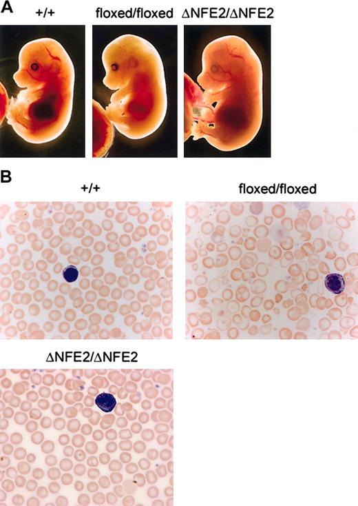 Figure 2. Floxed mutation causes α-thalassemia. (A) Dissected E14.5 embryos. HS-26 genotypes are indicated at the top. (B) Blood smears from adult mice, stained with Wright-Giemsa (original magnification, × 100). Note the target cells, hypochromic cells, and prominent fragments in the blood from the floxed/floxed mice. A white blood cell (purple) is shown in each panel for size comparison.