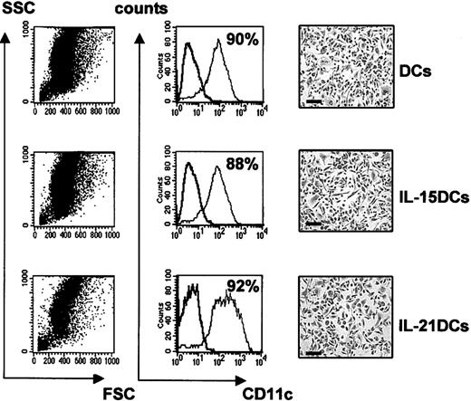 Figure 1. CD11c+ DCs differentiate in the presence of IL-15 or IL-21. Murine BM cells were induced to differentiate to DCs by GMCSF alone (DCs; top row) or by addition of IL-15 (IL-15 DCs; middle row) or IL-21 (IL-21 DCs; bottom row) during the entire culture period of 8 days. Cells were analyzed by forward (FSC) and sideward (SSC) scatter (left column) and CD11c expression (middle column) using FACS analysis at day 8. The percentage of CD11c-expressing cells is shown in each panel in the middle column. One representative of 10 experiments is shown. Morphology was assessed by culturing the DCs for 48 hours on microchamber slides (right column) following Pappenheim staining. The scale bar is equal to 100 μm.