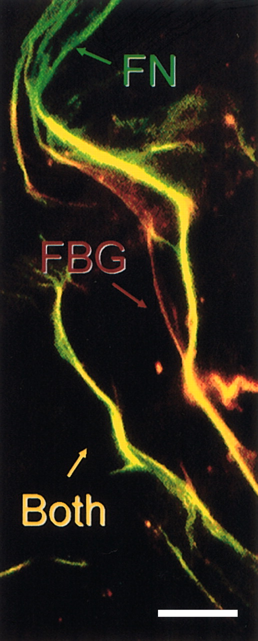 Figure 6. The cryptic fibrinlike β15-21 epitope is exposed in matrix-FBG fibrils that colocalize with FN fibrils. Confluent monolayers of HFFs were treated with purified plasma FBG at 40 μg/mL for 24 hours. FBG matrix fibrils were detected with MoAb T2G1 (red fluorescence), which recognizes the neo-NH2-terminus (β15-21) of the fibrin β chain, and FN matrix fibrils (green fluorescence) were detected with polyclonal antihuman FN IgG. Very few isolated fibrils of FN (green) or FBG (red staining) are found in the matrix; most FBG colocalizes with FN fibrils (yellow fluorescence), indicating that the cryptic β15-21 epitope is exposed in FBG matrix fibrils distributed along the length of FN matrix fibrils. Scale bar represents 25 μm.