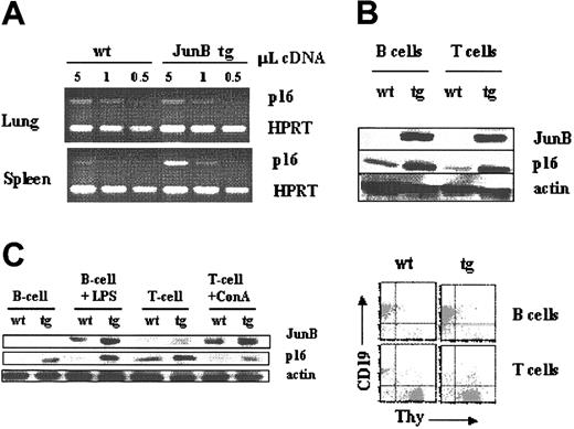 Figure 4. JunB overexpression in B lymphocytes is accompanied by an increased expression of the cyclin-dependent kinase inhibitor protein p16. (A) Semiquantitative RT-PCR analysis of p16 mRNA levels in lung and spleen from Ubi-junB transgenic animals and their wild-type littermate controls. (B) B- and T-lymphoid cells were MACS sorted from spleen of wild-type and Ubi-junB transgenic mice and subjected to Western blot analysis (upper panel) for JunB, p16, and β-actin (loading control). One representative FACS analysis of the purified B- and T-lymphoid cells after MACS purification is depicted (lower panel). (C) B- and T-lymphoid cells were MACS sorted from spleen of wild-type and Ubi-junB transgenic mice, stimulated with growth stimuli as indicated, and subjected to Western blot analysis for JunB, p16, and β-actin (loading control).