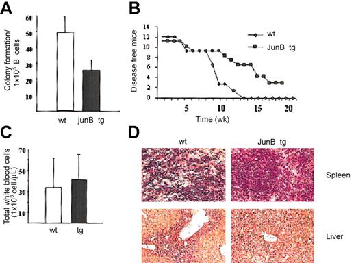 Figure 5. JunB overexpression reduces Ab-MuLV-induced colony formation in vitro and tumor formation in vivo. (A) Clonal outgrowth of Abelson-infected fetal liver cell suspensions. Fetal livers from wild-type (n = 6) and JunB transgenic (n = 9) mice were infected with Abelson retrovirus and subsequently cloned in cytokine-free methylcellulose. The initial number of B cells was determined by FACS. Results show the average numbers ± SD of colonies obtained per 1 × 105 B cells plated (n = 13 for JunB tg and n = 8 for wild-type fetal liver cells). Mock-infected cells were used as controls and did not give rise to colonies. (B) Newborn mice were injected intraperitoneally with replication-deficient v-abl retrovirus and observed over a period of 8 months. During this time, 3 of 11 JunB transgenic mice remained free of any leukemia/lymphoma. (C) White blood cell count in wild-type (n = 6) and Ubi-junB transgenic animals (n = 7) at the time point of fully developed disease. Data represent means ± SDs. (D) Histologic sections of spleen and liver from diseased wild-type and Ubi-junB transgenic animals. Leukemic cells heavily infiltrate wild-type liver and spleen but to a lesser degree JunB transgenic organs. One representative example of each genotype is depicted (n = 3). Panels stained with H&E; original magnification, × 100.