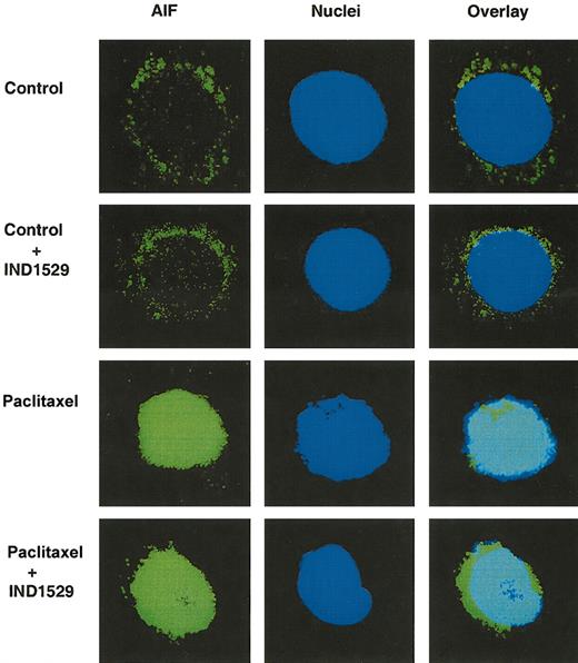 Figure 5. Effects of paclitaxel on nuclear translocation of AIF with or without caspase inhibitor IDN-1529. OCI-AML3 cells were treated with 50 ng/mL paclitaxel for up to 48 hours, with or without the caspase inhibitor IDN-1529 (Inh I) (20 μM). Cells were fixed, immunofluorescence stained, and analyzed using a fluorescence microscope and a confocal laser scanning biologic microscope. Images on the left show AIF immunofluorescence staining (FITC-green). Images in the center show nuclei stained with To-Pro 3. Images on the right demonstrate the overlay of AIF and nuclear staining. Green signals surrounding the nuclei represent the cytoplasmic AIF (control and control + IDN-1529 cells). The overlay of green and blue in the nuclei represents the nuclear AIF (Taxol and Taxol+IDN-1529-treated cells). Original magnification is × 90 for all images.