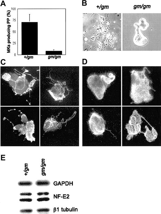 Figure 1. Proplatelet formation defects in gm/gm MKs. (A) Proplatelet formation is reduced approximately 10-fold in gm/gm MKs. Mouse fetal liver cells were cultured in thrombopoietin for 4 days before isolation of MKs that were analyzed for proplatelet formation the following day by phase-contrast microscopy. The percentage of proplatelet (PP)-producing MKs is expressed as mean ± SD. (B) Phase-contrast micrographs of representative +/gm and gm/gm cells on culture day 5. The +/gm MKs elaborate rich proplatelet networks, whereas gm/gm MKs only form a few blunt pseudopodia. (C-D) Immunofluorescent detection of β1 tubulin in cultured +/gm (C) and gm/gm (D) MKs. The increased sensitivity of this assay reveals that gm/gm MKs initiate proplatelet formation but the cytoplasmic extensions develop and elongate poorly. Original magnifications, × 400. (E) Immunoblot analysis of cultured +/gm and gm/gm MKs showing normal levels of β1 tubulin and p45 NF-E2. Glyceraldehyde 3-phosphate dehydrogenase (GAPDH) is used as a loading control.