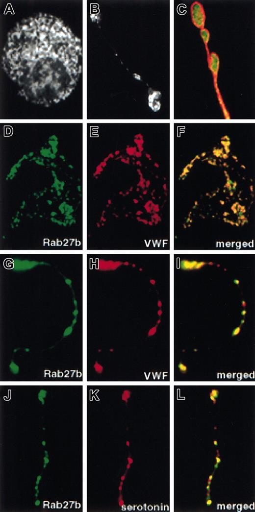 Figure 6. Colocalization of Rab27b with α and dense granules in MKs. (A-B) Immunolocalization of Rab27b in the MK cell body (A) and in proplatelet extensions (B). Staining is granular in both sites. MKs were cytocentrifuged onto glass slides, fixed, and stained with the Rab27b-specific R27B1 antibody, followed by FITC-conjugated goat antirabbit IgG. (C) Rab27b is not exclusively associated with the lineage-specific thick marginal microtubule cytoskeleton, as revealed by costaining with R27B1 and a mouse β-tubulin monoclonal antibody (detected using Texas Red-conjugated donkey antimouse IgG). (D-I) Colocalization of Rab27b with the α-granule marker VWF in the cell body and in proplatelet shafts, as revealed through separate immunostaining for Rab27b (D,G; antibody directly conjugated to FITC), VWF (E,H; antibody directly conjugated to Texas Red), and merging of the images (F,I). (J-L) Colocalization of Rab27b with the dense-granule marker serotonin in proplatelets, as revealed through separate immunostaining for Rab27b (J), serotonin (K; rat antiserotonin detected using Texas Red-conjugated goat antirat IgG), and merging of the images (L). Original magnifications, × 600 (A, D-F); and × 1000 (B-C, G-L).