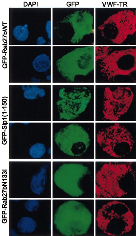 Figure 7. Immunofluorescent localization of VWF in primary MKs transfected with wild-type or dominant-negative versions of Rab27. There is no change in the distribution or abundance of VWF in MKs expressing GFP-tagged wild-type (WT, n = 50) or dominant-negative forms Rab27bN133I (n = 54) or Slp1(1-150) (n = 40). MKs were transfected with GFP fusion constructs and harvested 24 hours later, cytocentrifuged onto glass slides, fixed, immunostained for VWF, and scored individually. Cells were mounted with aqueous medium containing DAPI (4,6 diamidino-2-phenylindole) and visualized by fluorescence microscopy. Original magnifications, × 400 for all panels.