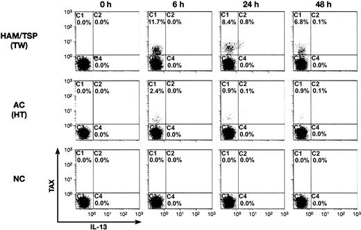 Figure 5. Kinetics of IL-13 and Tax expression during in vitro culture of PBMCs from HTLV-1-infected individuals. PBMCs prepared from a HAM/TSP patient (TW; top), an HTLV-1-positive asymptomatic carrier (HT; middle), and an HTLV-1-negative healthy control (NC; bottom) were stained and analyzed by flow cytometry as in Figure 4. PBMCs were stained and analyzed immediately after preparation (0 hour) or incubated in medium containing Brefeldin A and Concanamycin A for the time periods indicated at the top of the figure (6, 24, and 48 hours) prior to analysis. Fluorescence intensities of Tax (y-axis) and IL-13 (x-axis) are plotted for CD4+ T cells.