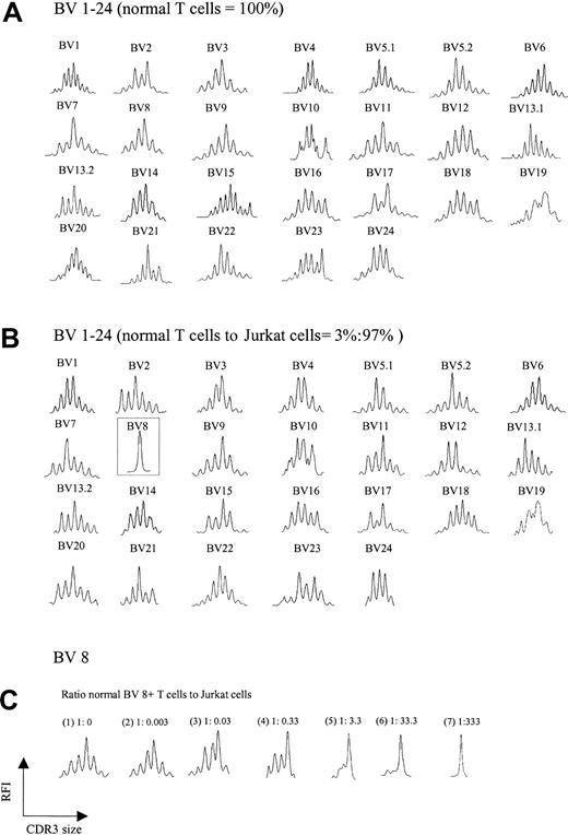 Figure 2. TCR BV repertoire in normal T cells and cell mixtures of these with Jurkat cells. (A) CDR3 spectratypes of T cells from a healthy donor showing highly diverse profiles reflecting a heterogeneous TCR repertoire. (B) Spectratype profiles of the cell mixtures containing 3% normal T cells and 97% Jurkat cells. As observed in panel A, polyclonal spectratype profiles were readily found across the other TCR BV subfamilies, even though 97% of the analyzed cells were composed of a clonal population (note the dominant peak in BV 8, representing Jurkat cells). (C) Spectratype profiles of BV 8 from pure normal T cells (1) and normal T cells spiked with increasing numbers of Jurkat cells (2-7). A single dominant peak was observed at a ratio of normal BV 8+ T cells to Jurkat cells of 1:333.