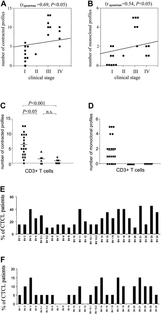 Figure 3. Correlation of degree of spectratype abnormality with stage of disease. A significant correlation was found between the number of contracted (A) and monoclonal (B) spectratypes and the clinical stage. (C) Quantification and statistical analysis of the number of contracted profiles in CTCL (▪), psoriasis (▴), and healthy donors (▾). A contracted profile was defined as having 0 to 4 distinct peaks. CDR3 spectratyping was performed from CD3+ T cells. Statistically significant perturbations of the TCR repertoire of patients with CTCL were found as compared with patients with psoriasis and healthy control donors. Horizontal bars show mean values. Statistical analysis is indicated. (D) Quantification and statistical analysis of the number of monoclonal profiles in patients with CTCL (▪) and psoriasis (▴) and healthy donors (▾). Markedly increased numbers of monoclonal profiles were found in patients with CTCL as compared with patients with psoriasis and healthy control donors. Horizontal bars show mean values. (E-F) BV families appear to be affected in a nonrandom fashion. The percentage of patients with CTCL with contracted (E) and monoclonal (F) profiles is shown.