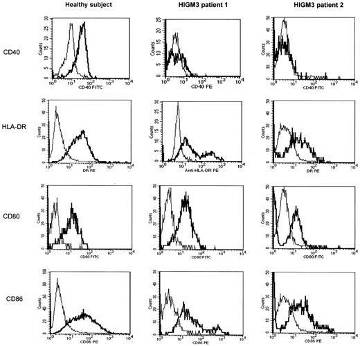 Figure 1. Fluorescence-activated cell sorter (FACS) analysis of expression of CD40, HLA-DR, CD80, and CD86 molecules by immature DCs from a healthy subject and from HIGM3 patients 1 and 2. Monocyte-derived immature DCs were cultured as described in “Patients, materials, and methods,” incubated with the appropriate antibody, washed twice, and analyzed using a flow cytometer. Expression of CD80 and CD86 was analyzed by CD80-FITC/CD86-PE double staining. Expression of CD40 was analyzed by CD40-FITC single staining (except for HIGM3 patient 1, in whom we used PE-conjugated anti-CD40 mAb) and HLA-DR expression by HLA-DR-PE staining. CD40, HLA-DR, CD80, and CD86 antibody stainings are presented (thick line) in comparison with mouse IgG antibody (thin line). The x-axis represents the intensity of green (or red) fluorescence expressed in a log scale as mean channel, and the y-axis represents the number of cells per channel. Data shown are from 1 of 3 representative, independent experiments.