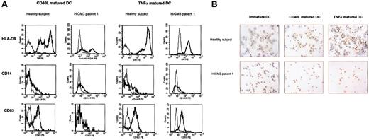Figure 2. Expression of CD14, HLA-DR, CD83, and DC-LAMP by DCs on maturation with CD154 trimer or TNF-α of HIGM3 patients. (A) FACS analysis of CD14, HLA-DR, and CD83 expression by DCs on maturation with CD154 trimer or TNF-α from a healthy subject and from HIGM3 patients. Monocyte-derived DCs were cultured and matured with coated CD154 trimer or TNF-α, as described in “Patients, materials, and methods,” and were incubated with the appropriate antibody, washed twice, and analyzed using a flow cytometer. Expression of CD14 and HLA-DR was analyzed by CD14-FITC/HLA-DR-PE double staining. Extent of CD83 expression was analyzed by CD83-PE single staining. HLA-DR, CD14, and CD83 antibody stainings are presented (thick line) in comparison with mouse IgG antibody (thin line). The x-axis represents the intensity of green or red fluorescence expressed in a log scale as mean channel, and the y-axis represents the number of cells per channel. Data shown are representative of 3 independent experiments. (B) HIGM3 patient DCs fail to express DC-LAMP on CD154 stimulation. Monocyte-derived immature and CD154 trimer or TNF-α matured DCs were cultured as described in “Patients, materials, and methods.” After cytospin preparation and immunocytochemical staining with DC-LAMP monoclonal antibody, cells were photographed using an optic microscope. Original magnification, × 200. Data are from 1 of 2 representative experiments.