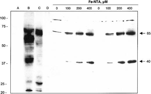 Figure 3. Immunoblot analysis of FPN1 protein expression in J774 macrophages. Lysates were collected from HEK293T cells transfected with pSPORT2 CMV vector (lane A) or pSPORT2 CMV containing full-length mouse FPN1 cDNA (lane B). Additional control lysates were prepared from duodenal (lane C) and ileal (lane D) mucosal cells from a bled rat (material provided by Dr Ramon Molina, Harvard School of Public Health, Boston, MA). Cell lysates were also prepared from J774 cells incubated for 40 hours with the indicated concentrations of Fe-NTA. Results from 2 different samples at each Fe-NTA treatment concentration are shown. Protein samples were prepared for electrophoresis as described in “Materials and methods” and separated on a 10% SDS polyacrylamide gel; 100-μg aliquots were electrophoresed except for lane B, which contained 1 μg. Proteins were transferred to nitrocellulose for immunoblotting as detailed in “Materials and methods.” Arrows on the right identify the positions and estimated mass (kDa) of iron-responsive FPN1-immunoreactive bands. The position and mass (in kDa) of molecular weight markers (Precision Plus Protein standards, All Blue; Bio-Rad) are indicated on the left. Results shown are representative of 3 independent experiments.