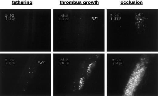Figure 7. Inhibition of metalloproteinase activity during mitochondrial injury improves hemostatic function of platelets in arterial thrombosis. Washed platelets were treated for 60 minutes with CCCP (top row) or GM6001/CCCP (bottom row), labeled with calcein, and infused into anesthetized mice. Vascular injury was induced by superfusion with FeCl3; thrombus growth was monitored until blood flow stopped. Images were selected to visualize the ability of treated platelets to adhere to the damaged vessel wall (tethering) and incorporate into the growing thrombus. GM6001/CCCP-treated platelets were incorporated into the growing thrombus to an extent similar to that seen with untreated platelets.24