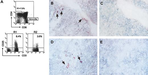 Figure 1. Identification, localization, and purification of CD8+CD25+ human thymocytes. (A) Freshly isolated human thymocytes were assessed for expression of CD3, CD4, CD8, and CD25 by flow cytometry. Gated CD4+ (R1) or CD8+ (R2) SP thymocytes were assessed for CD3 and CD25. (B) Staining of a thymic section with anti-CD8 (bluish gray) plus anti-CD25 (red) mAbs. Arrows indicate cells showing double staining in the fibrous septa. (C) A consecutive section stained with anti-CD8 (bluish gray) plus isotype control (red) mAbs. (D) Staining of a thymic section with anti-CD8 (bluish gray) plus anti-CD25 (red) mAbs. Arrows indicate cells showing double staining in the medulla. (E) A consecutive section stained with anti-CD8 (bluish gray) plus isotype control (red) mAbs. Original magnification, ×400 for panels B-E.