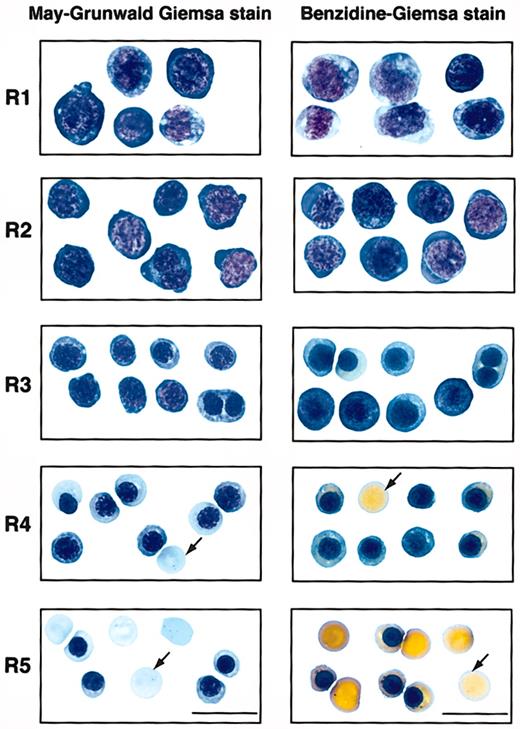 Figure 2. Sorted R1 to R5 cells that represent erythroblasts at different developmental stages. E14.5 fetal liver cells were double stained for TER119 and CD71 and sorted into R1 to R5 populations as described in Figure 1. The left panels show May-Grunwald Giemsa–stained cytospin preparations of cells sorted from each region of R1 to R5. Representative cells from 2 to 5 fields are shown in each region. These are predominantly primitive progenitor cells (including mature BFU-Es and CFU-Es) in R1, proerythroblasts and early basophilic erythroblasts in R2, early and late basophilic erythroblasts in R3, chromatophilic and orthochromatophilic erythroblasts in R4, and late orthochromatophilic erythroblasts and reticulocytes in R5. The right panels show the cytospin preparations of R1 to R5 cells processed by benzidine-Giemsa stain. Representative cells from several fields are shown in each region. Cells from the R1 and R2 regions are benzidine-negative. R3 is a mixture of benzidine-negative and benzidine-positive cells. Cells sorted from the R4 and R5 regions are all benzidine-positive. Arrows indicate enucleated reticulocytes. Scale bar: 20 μm.