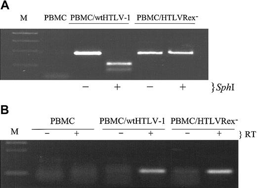 Figure 5. T lymphocytes immortalized by HTLVRex- contain the expected Rex- mutation and express tax/rex mRNA. (A) HTLV-1 genome fragment containing the Rex start codon was amplified by PCR from high molecular weight DNA of wtHTLV-1 and HTLVRex- immortalized cells. PCR-amplified product was incubated in the presence or absence of SphI, separated on 2% agarose gel, and visualized by ethidium bromide staining. (B) Detection of tax/rex mRNA in the wtHTLV-1 and HTLVRex- immortalized PBMCs. Total RNA was prepared from fresh PBMCs, wtHTLV-1, and HTLVRex- immortalized PBMCs. Approximately 0.3 μg RNA was subjected to a coupled 40-cycle RT-PCR in the presence (+) or absence (-) of reverse transcriptase (RT). Following RT-PCR, 25-cycle nested PCR was performed. PCR product was separated on 2% agarose gel and visualized by ethidium bromide staining.