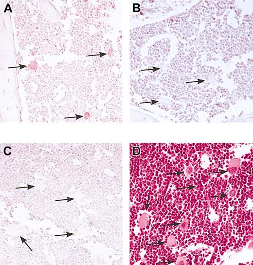 Figure 2. Marrow immunostain for transgenic hB-FVIII. Femoral marrow from line no. 38 hB-FVIII/FVIIInull animals (A,C,D) and from FVIIInull animals (B) was immunostained for hFVIII (A-B) or with a sheep serum control (C). Hematoxylin and eosin stain was done on the marrow from the hB-FVIII/FVIIInull mice to demonstrate the clear morphology of the megakaryocytes present (D). Only megakaryocytes in the line no. 38 marrow were positive for hFVIIIs. Arrows point to representative mature megakaryocytes in each figure. Original magnification, × 100.