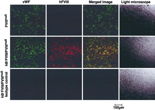 Figure 3. Confocal fluorescent microscopic studies for transgenic hB-FVIII and murine VWF. Isolated platelets from FVIIInull animals (top row) and line no. 38 hB-FVIII/FVIIInull animals (middle and bottom rows) were immunostained for either mouse VWF (left column) or hFVIII (second column from left). The 2 images were overlapped in the third column, showing that in the line no. 38 platelets there was overlap of VWF and hFVIII distributions. Right column shows light microscopy of the platelets.