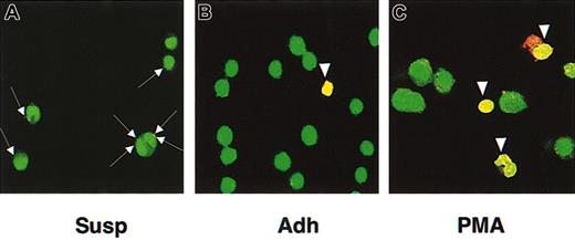 Figure 1. Cell adherence renders K562 cells permissive for parvovirus B19 entry and nuclear localization. K562 cells grown in suspension (Susp) could bind parvovirus B19 (A; arrows) in the presence of divalent ions (1 mM Mn2+, 1 mM Mg2+) but did not allow viral entry. Upon spontaneous adherence (Adh), virus entry and nuclear localization were seen in about 7% of K562 cells (B; arrowhead), the extent of which is increased to about 29% upon PMA treatment (C; arrowheads). K562 cells were infected with Cy3-labeled recombinant parvovirus B19 for 30 minutes, fixed, and nuclei stained with SYTO 16 green fluorescent nucleic acid stain. Confocal images were acquired using a Zeiss LSM510 confocal microscope. Original magnification, × 630 for all panels.