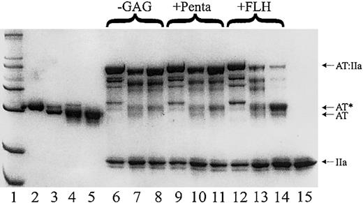 Figure 2. SDS-PAGE demonstrates that antithrombin Cambridge II is predominantly a substrate of thrombin in the presence of heparin. The electrophoretic mobility of plasma alpha (lane 2) and beta (lane 3) antithrombins compared to that of recombinant β-S137A (lane 4) and S137A, A384S (lane5) demonstrates the anticipated size of the recombinant β-antithrombin. An excess of thrombin (lane 15) was reacted with plasma alpha (lanes 6, 9, and 12), recombinant beta (lanes 7, 10, and 13), and the Cambridge II variant (lanes 8, 11, and 14) with and without heparins as indicated (-GAG for no glycosaminoglycan, +Penta for with the pentasaccharide, and +FLH for with full-length heparin). The gel clearly shows that nearly all of the antithrombin reacts with thrombin and either forms complex (high molecular weight bands) or cleaved antithrombin (AT*). The Cambridge II variant is mostly cleaved in the presence of FLH.