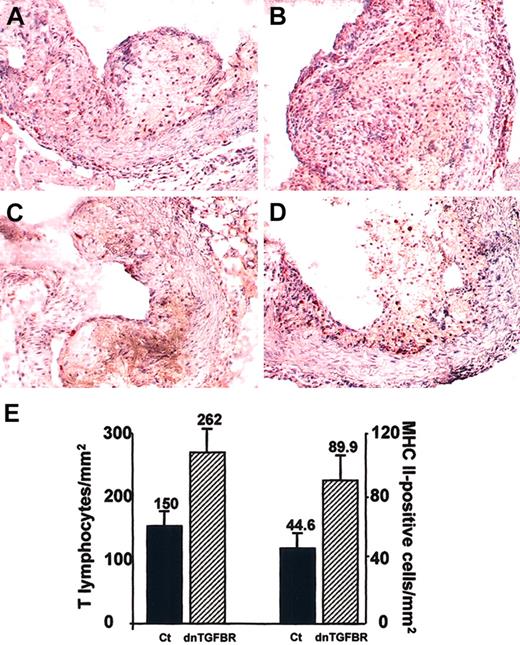 Figure 3. Inflammatory content of atherosclerotic lesions. Representative photomicrographs showing atherosclerotic lesions in the aortic sinus of control (A,C) or CD2-dnTGFBRII (B,D) LDLr KO mice. CD3 staining was detected by staining with antimouse CD 3-ϵ (small red spots in A and B). MHC class II expression in the lesions was detected by staining with antimouse MHC class II (small red spots in C and D). Original magnification, × 200. (E) Quantitative analysis of CD3-positive (T lymphocytes) and MHC class II-positive cells in the atherosclerotic plaques of CD2-dnTGFBRII (n = 8) and control (Ct; n = 7) mice. Four to 5 sections per animal were analyzed for each immunostaining. Results are expressed as number of positive cells per mm2 lesion area (numbers above bars ± SEM). P < .05 for T lymphocytes; P = .01 for MHC class II.
