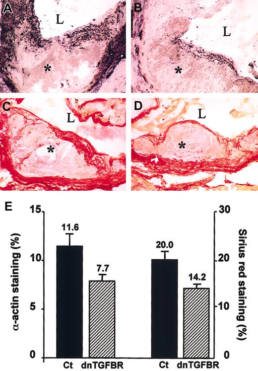 Figure 5. Smooth muscle cell and collagen content of atherosclerotic lesions. Representative photomicrographs showing atherosclerotic lesions in the aortic sinus of control (A,C) or CD2-dnTGFBRII (B,D) LDLr KO mice. Smooth-muscle cell content was detected by staining with anti-α-actin antibody (black staining; A-B). Collagen content in the lesions was detected by staining with Sirius red (red staining; C-D). * Indicates the intima; L, the lumen of the vessel. Original magnification, × 400. (E) Quantitative analysis of α-actin and Sirius red staining was performed using Histolab Microvision software. Four to 5 sections per animal were analyzed for each immunostaining; n = 7 to 8 per group. Results (means ± SE) are expressed as percentage of positive surface area. P = .03 for actin and P = .01 for Sirius red. Mean values are shown above bars.