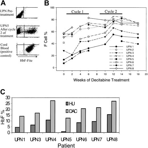 Figure 1. Decitabine increased fetal hemoglobin levels (HbF) in all treated patients. (A) Flow cytometric analysis for F cells (RBCs expressing high levels of HbF). The F-cell percentage is the proportion of gated RBCs with HbF expression similar to that of the cord blood positive control. (B) Change in F-cell percentage with treatment. (C) The peak HbF values with decitabine treatment (light gray bars) were higher than those measured during previous treatment with hydroxyurea (dark gray bars) for between 4 and 36 months. Peak HbF levels were not measured in UPN 2 during hydroxyurea treatment.
