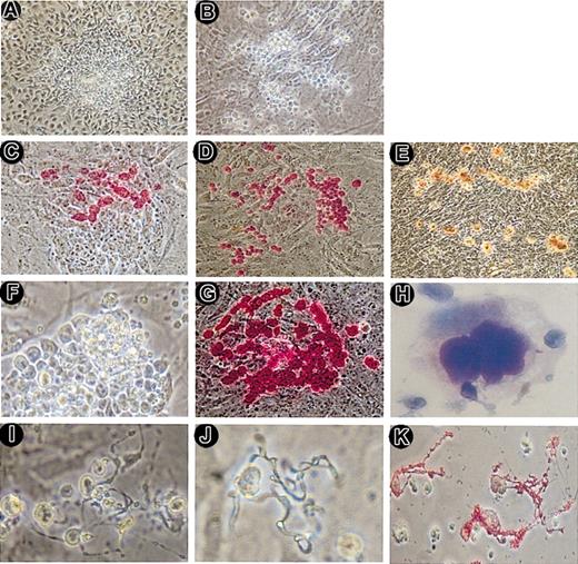 Figure 1. Megakaryocyte colony and proplatelet formation by ES-derived hematopoietic cells. A hematopoietic colony with unclear borders was formed on day 6 of differentiation (A). On day 12, a megakaryocyte colony with individually identifiable large cells appeared (B). These cells were visualized by immunostaining with anti-CD41 (GPIIb) antibody (C-D) and AChE staining (E). CD41+ mature megakaryocytes appeared at the periphery of the colonies. On day 13, almost all cells within the colonies became large (F). These cells were immunostained with an anti-CD41 antibody and were CD41+ (G). Cytospin preparation of the culture medium on day 13 was stained by Wright-Giemsa staining (H). On day 14 of culture, cells attached on the layer (I), floated in the medium (J), and in cytospin preparation (K) displayed proplatelet formation from mature megakaryocytes. The cytospin preparation (K) was immunostained with anti-CD41 antibody. Panels T and J were not stained. The proplatelets were CD41+ up to the top of the projections. Original magnifications were × 100 for panels A-E, × 200 for panels F-G, × 600 for panel H, and × 400 for panels I-K.