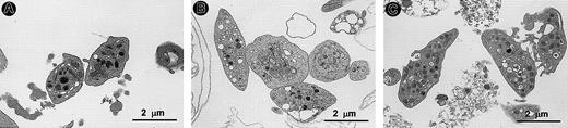 Figure 4. Transmission electron microscopy of platelets derived from ES cells.The morphology of platelets derived from ES cells was examined by transmission electron microscopy. Control normal platelets from mouse peripheral blood (A), ES cell-derived platelets from the first wave (day 10) (B), and platelets from the second wave (day 15) (C) are shown. Original magnification, × 10 000.