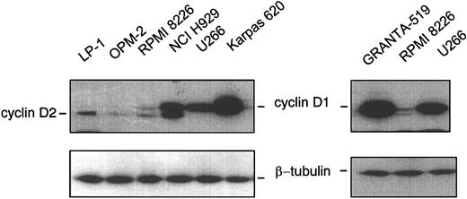 Figure 1. Western blot analysis. Procedures for protein extraction, sodium dodecyl sulfate-polyacrylamide gel electrophoresis (SDS-PAGE), and immunoblotting have been described in detail.6 The polyclonal anti-cyclin D1 and anti-β-tubulin antibodies, sc-718 and sc-9104, respectively, were purchased from Santa Cruz Biotechnology (Santa Cruz, CA). The lower bands observed are due to a cross-reactivity shown by anti-cyclin D1 antibody against cyclin D2.