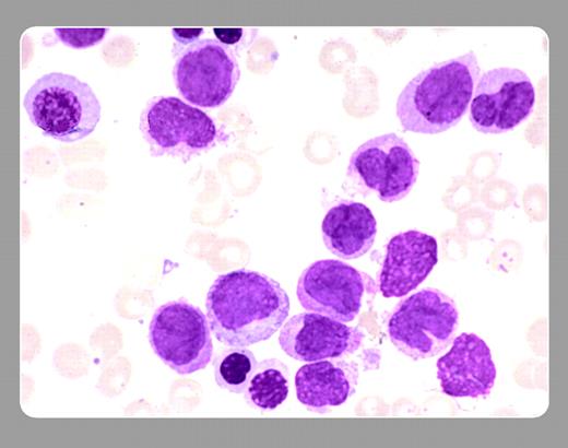 Peter Maslak and Susan McKenzie, Memorial Sloan-Kettering Cancer Center