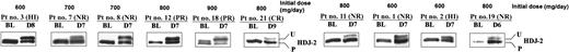 Figure 4. R115777 inhibits HDJ-2 farnesylation in PBMCs from patients with MDS. PBMCs were processed for SDS-PAGE Western immunoblotting with anti-HDJ-2 antibody, as described in “Patients, materials and methods.” BL, D6, D7, D8, and D9 indicate baseline pretreatment levels and days 6, 7, 8, and 9 after initiation of R115777 treatment, respectively. U indicates unprocessed HDJ-2; P, processed HDJ-2.